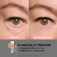 Lumera Rejuvenating Eye Cream™